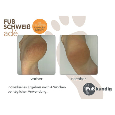 vorher nachher Fußschweiß